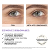Product Revitalift Filler Ορός Ματιών με Υαλουρονικό Οξύ 20ml thumbnail image